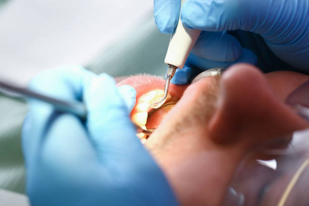 Best Emergency Gum Treatment in Bolivar, MO