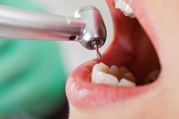 Best Emergency TMJ Treatment in Bolivar, MO